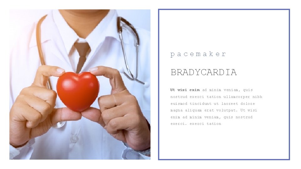 pacemaker BRADYCARDIA Ut wisi enim ad minim veniam, quis nostrud exerci tation ullamcorper nibh