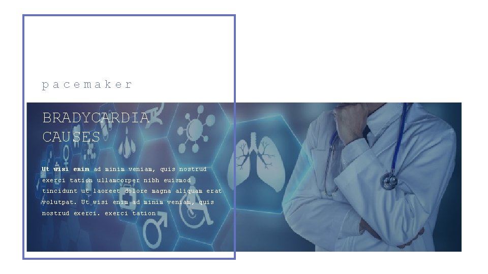 pacemaker BRADYCARDIA CAUSES Ut wisi enim ad minim veniam, quis nostrud exerci tation ullamcorper