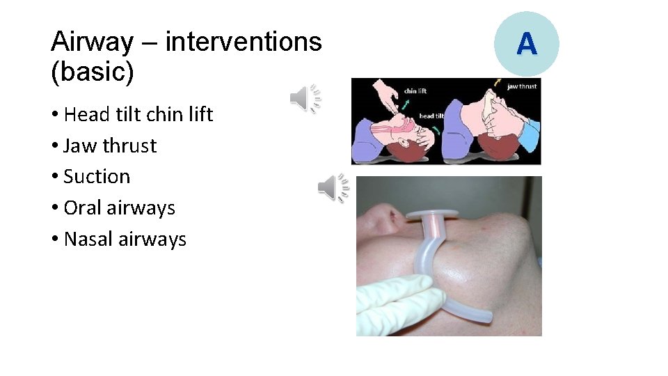 Airway – interventions (basic) • Head tilt chin lift • Jaw thrust • Suction