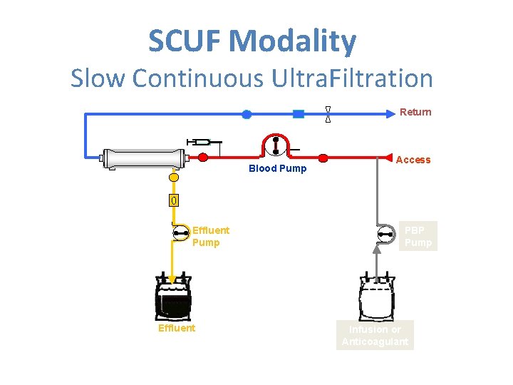 SCUF Modality Slow Continuous Ultra. Filtration Return Blood Pump Effluent Access PBP Pump Infusion