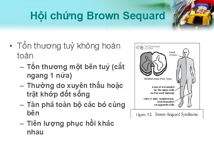 Hội chứng Brown Sequard • Tổn thương tuỷ không hoàn toàn – Tổn thương