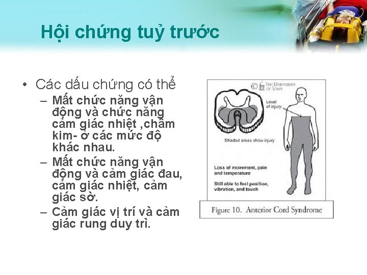 Hội chứng tuỷ trước • Các dấu chứng có thể – Mất chức năng