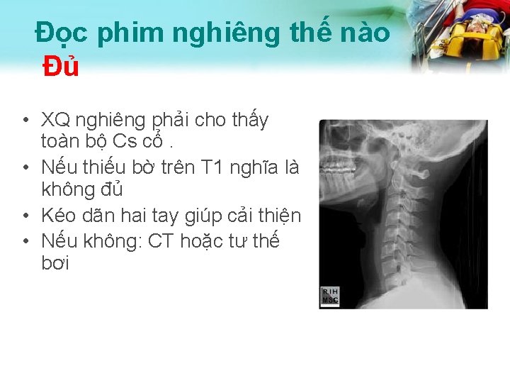 Đọc phim nghiêng thế nào Đủ • XQ nghiêng phải cho thấy toàn bộ