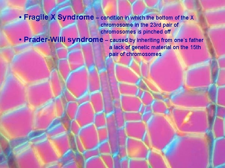  • Fragile X Syndrome – condition in which the bottom of the X