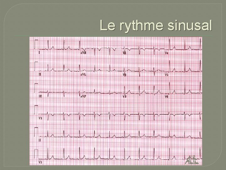 Le rythme sinusal 