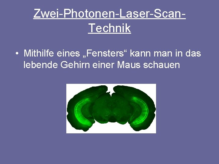 Zwei-Photonen-Laser-Scan. Technik • Mithilfe eines „Fensters“ kann man in das lebende Gehirn einer Maus