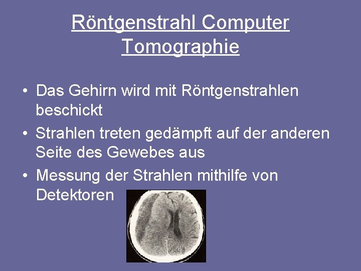 Röntgenstrahl Computer Tomographie • Das Gehirn wird mit Röntgenstrahlen beschickt • Strahlen treten gedämpft