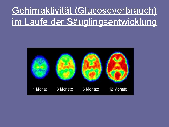 Gehirnaktivität (Glucoseverbrauch) im Laufe der Säuglingsentwicklung 