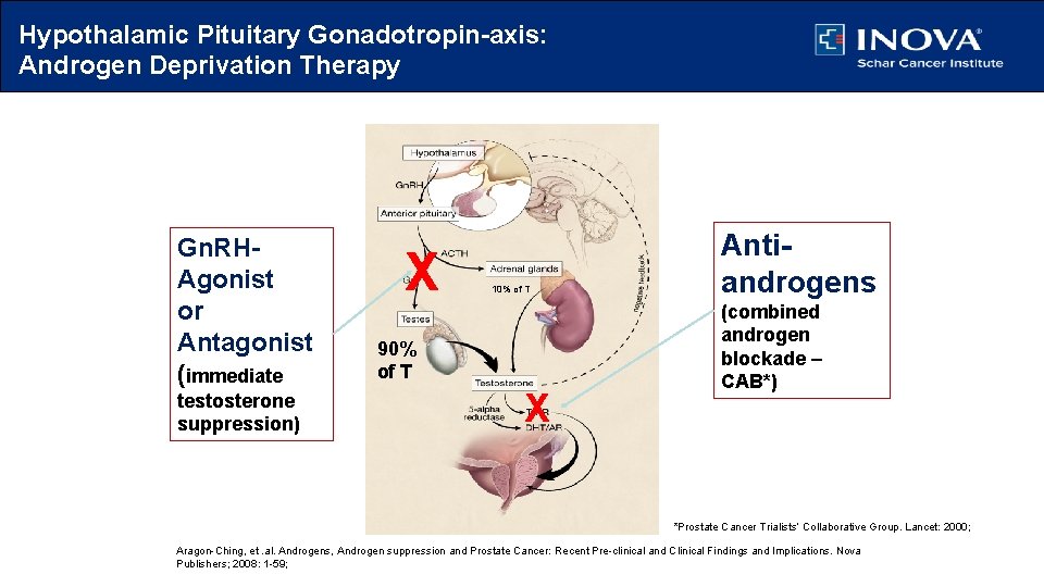 Hypothalamic Pituitary Gonadotropin-axis: Androgen Deprivation Therapy Gn. RHAgonist or Antagonist (immediate testosterone suppression) X