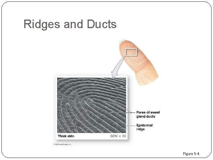 Ridges and Ducts Figure 5– 4 