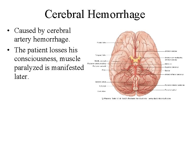 Cerebral Hemorrhage • Caused by cerebral artery hemorrhage. • The patient losses his consciousness,