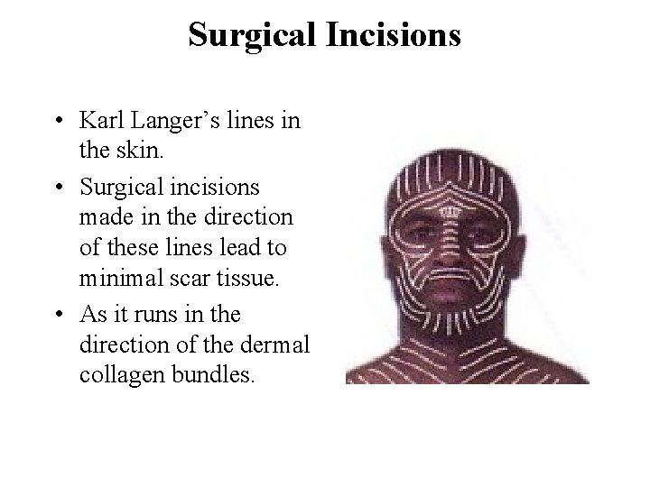 Surgical Incisions • Karl Langer’s lines in the skin. • Surgical incisions made in