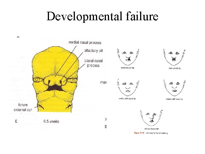 Developmental failure 