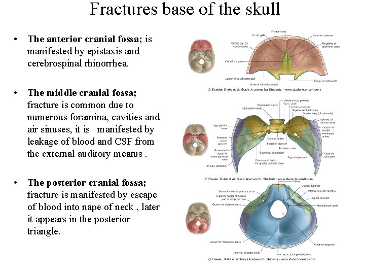 Fractures base of the skull • The anterior cranial fossa; is manifested by epistaxis Fractures base of the skull • The anterior cranial fossa; is manifested by epistaxis