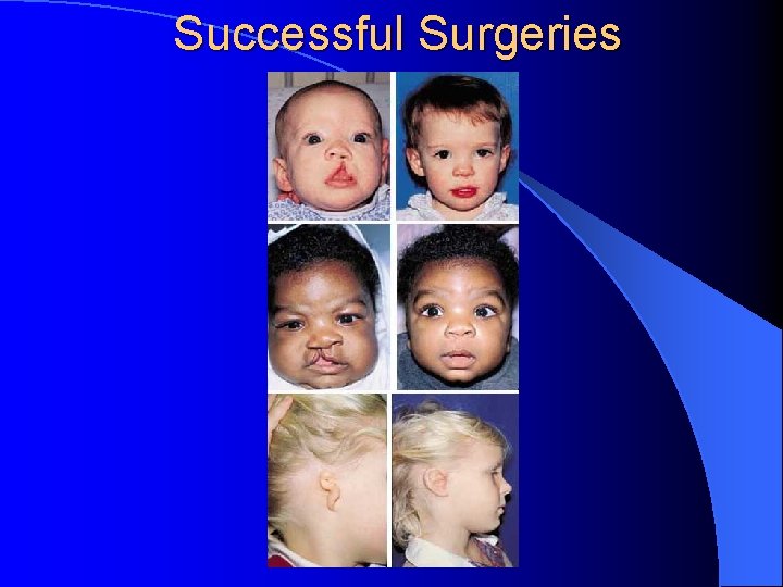 Successful Surgeries 