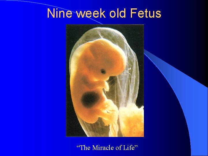 Nine week old Fetus “The Miracle of Life” 