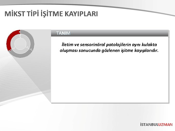 TANIM İletim ve sensorinöral patolojilerin aynı kulakta oluşması sonucunda gözlenen işitme kayıplarıdır. İSTANBULUZMAN 