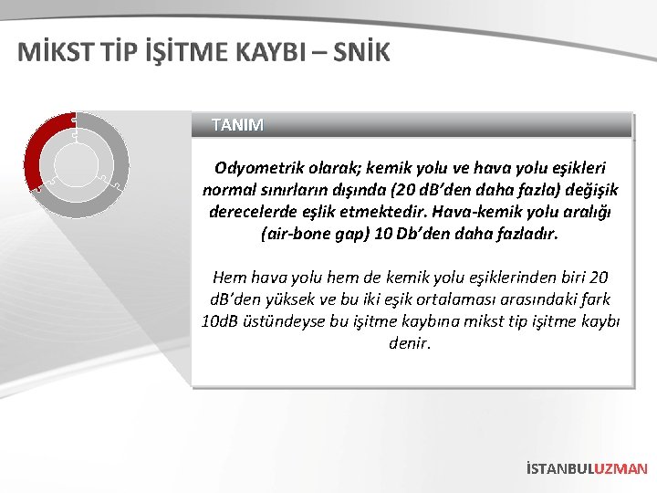 TANIM Odyometrik olarak; kemik yolu ve hava yolu eşikleri normal sınırların dışında (20 d.