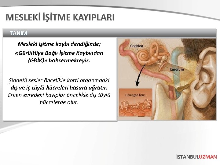 TANIM Mesleki işitme kaybı dendiğinde; «Gürültüye Bağlı İşitme Kaybından (GBİK)» bahsetmekteyiz. Şiddetli sesler öncelikle