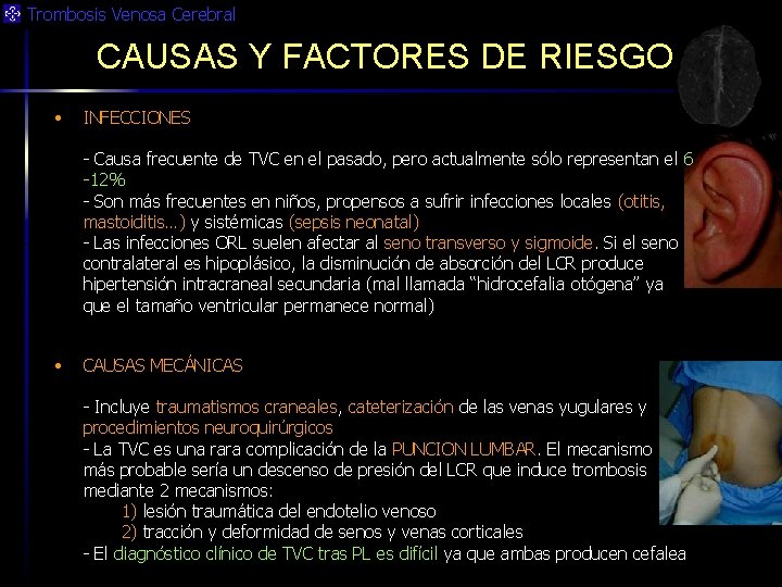 Trombosis Venosa Cerebral CAUSAS Y FACTORES DE RIESGO • INFECCIONES - Causa frecuente de