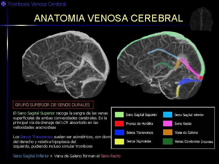 Trombosis Venosa Cerebral ANATOMIA VENOSA CEREBRAL GRUPO SUPERIOR DE SENOS DURALES El Seno Sagital