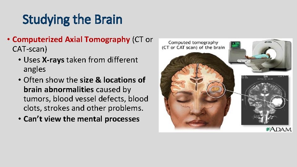 Studying the Brain • Computerized Axial Tomography (CT or CAT-scan) • Uses X-rays taken