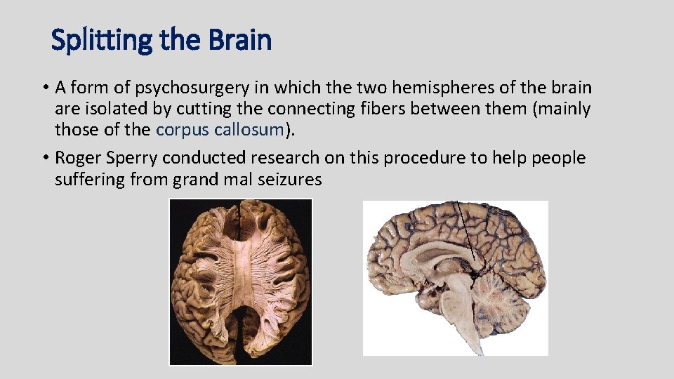 Splitting the Brain • A form of psychosurgery in which the two hemispheres of