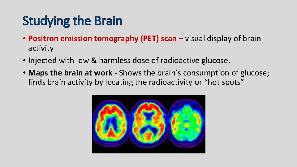 Studying the Brain • Positron emission tomography (PET) scan – visual display of brain