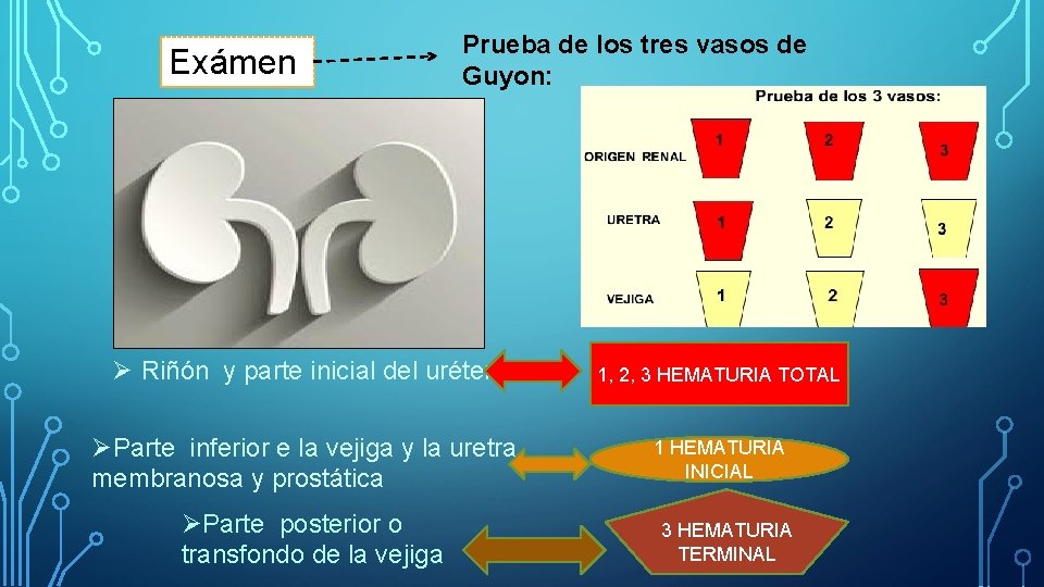 Exámen es Prueba de los tres vasos de Guyon: Ø Riñón y parte inicial