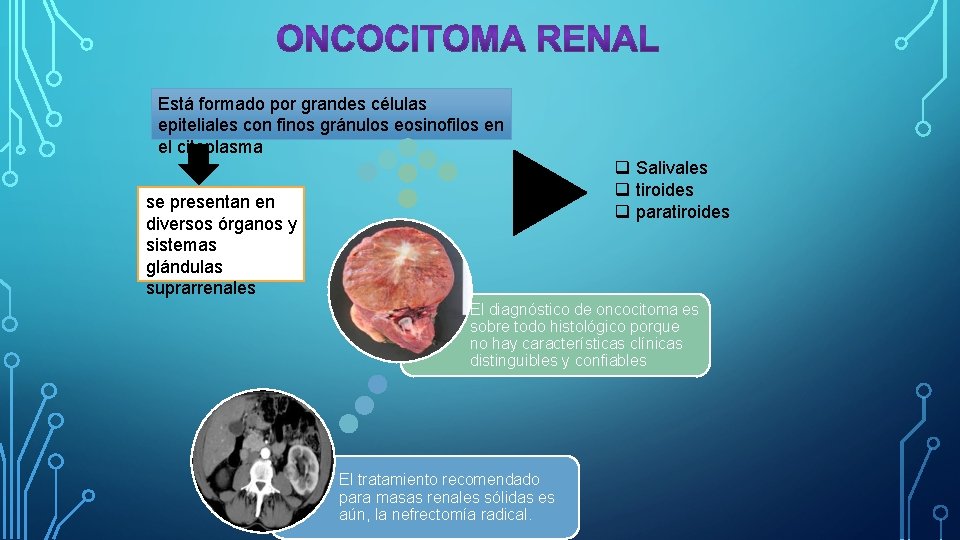 Está formado por grandes células epiteliales con finos gránulos eosinofilos en el citoplasma q