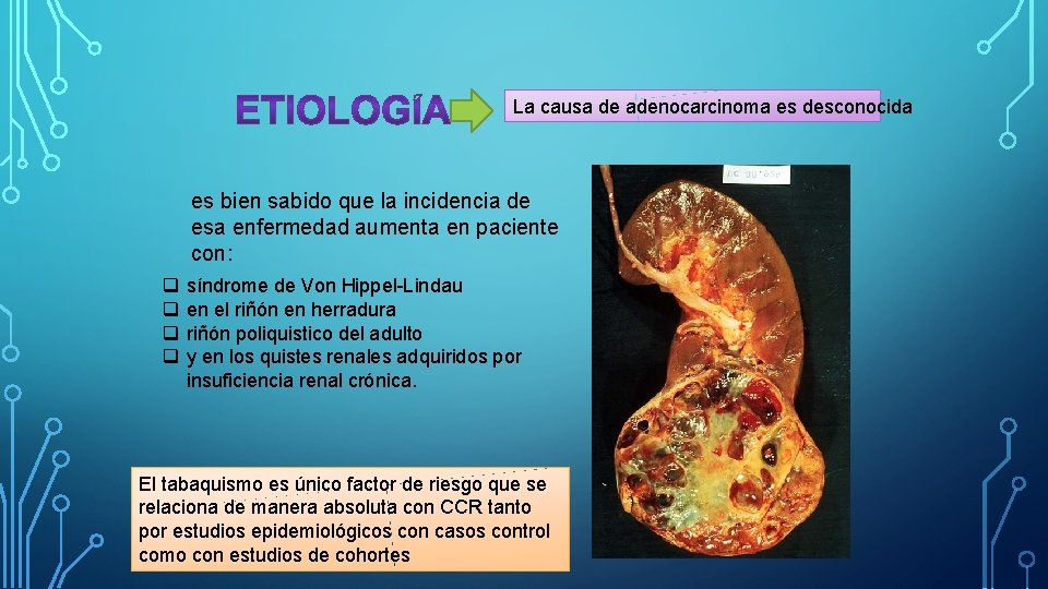 La causa de adenocarcinoma es desconocida es bien sabido que la incidencia de esa