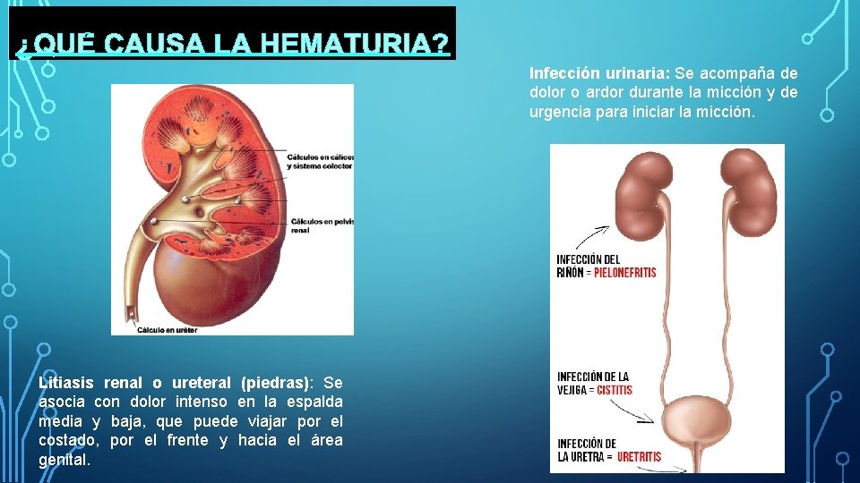 Infección urinaria: Se acompaña de dolor o ardor durante la micción y de urgencia