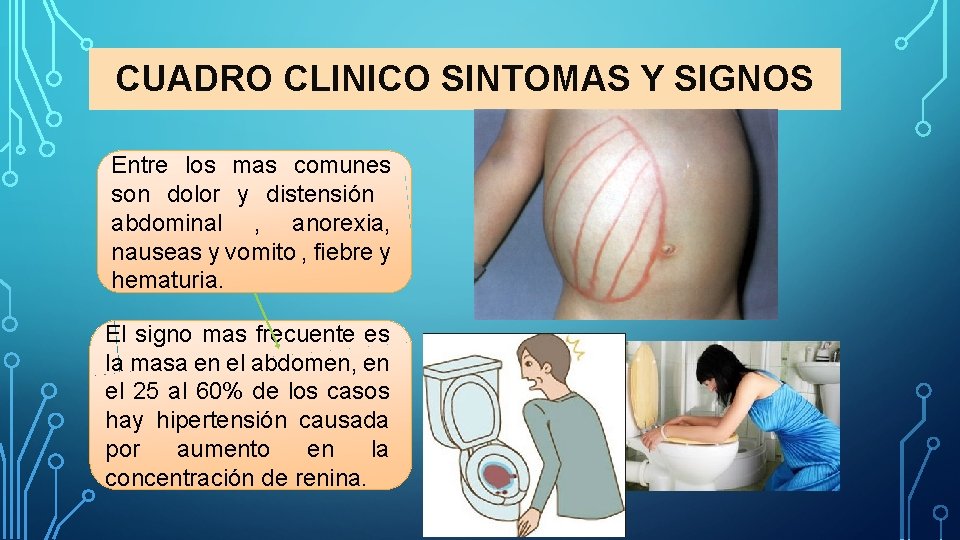 CUADRO CLINICO SINTOMAS Y SIGNOS Entre los mas comunes son dolor y distensión abdominal