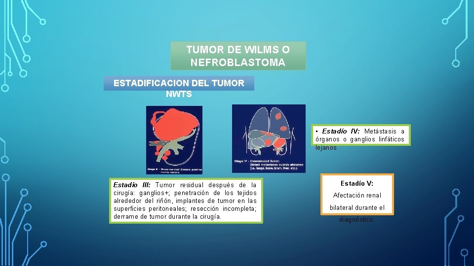 TUMOR DE WILMS O NEFROBLASTOMA ESTADIFICACION DEL TUMOR NWTS • Estadío IV: Metástasis a