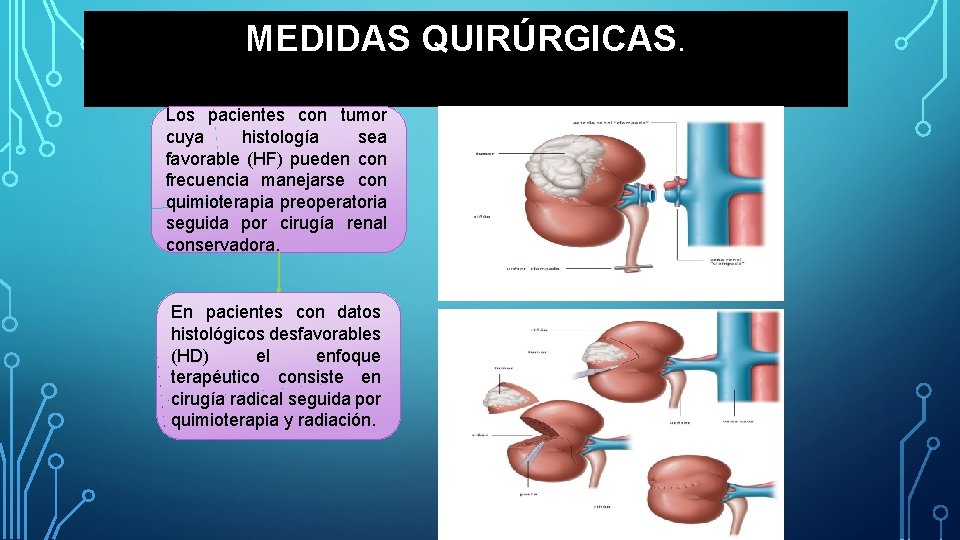 MEDIDAS QUIRÚRGICAS. Los pacientes con tumor cuya histología sea favorable (HF) pueden con frecuencia