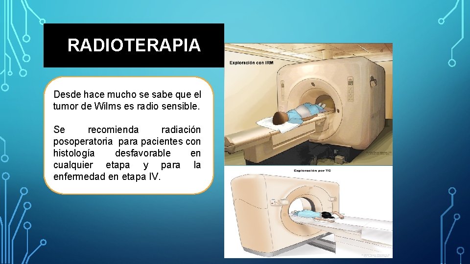 RADIOTERAPIA Desde hace mucho se sabe que el tumor de Wilms es radio sensible.