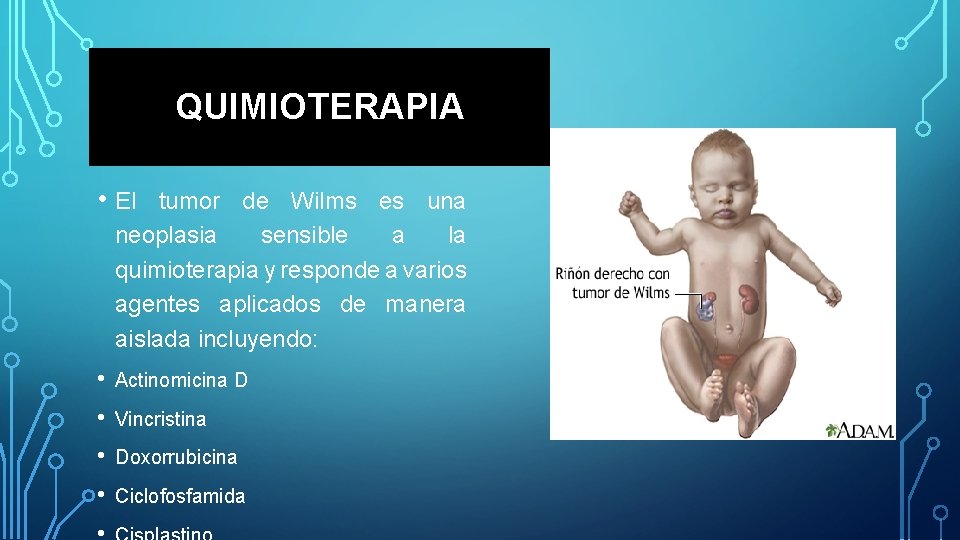 QUIMIOTERAPIA • El tumor de Wilms es una neoplasia sensible a la quimioterapia y