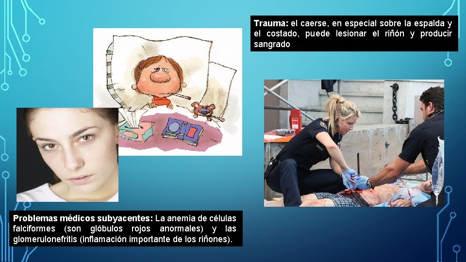 Trauma: el caerse, en especial sobre la espalda y el costado, puede lesionar el