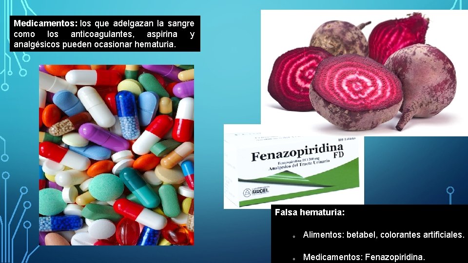 Medicamentos: los que adelgazan la sangre como los anticoagulantes, aspirina y analgésicos pueden ocasionar