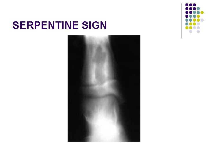 SERPENTINE SIGN 