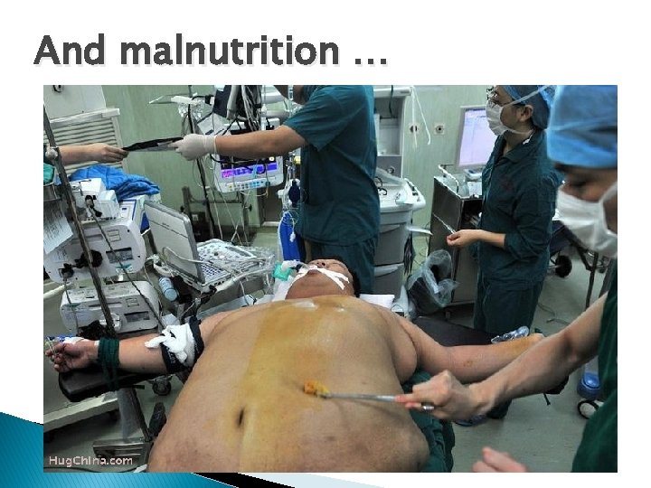 And malnutrition … 