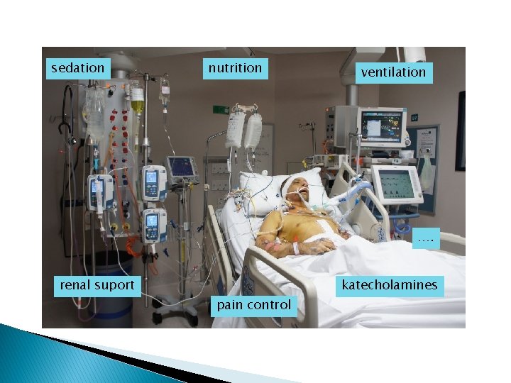 sedation nutrition ventilation …. renal suport katecholamines pain control 