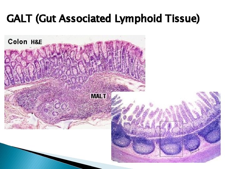 GALT (Gut Associated Lymphoid Tissue) 