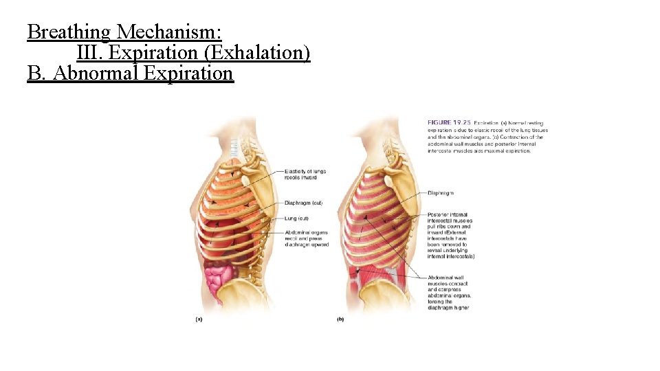 Breathing Mechanism: III. Expiration (Exhalation) B. Abnormal Expiration Breathing Mechanism: III. Expiration (Exhalation) B. Abnormal Expiration