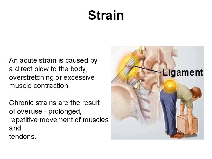 Strain An acute strain is caused by a direct blow to the body, overstretching