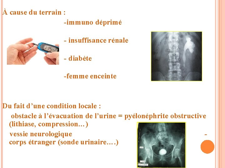 À cause du terrain : -immuno déprimé - insuffisance rénale - diabète -femme enceinte