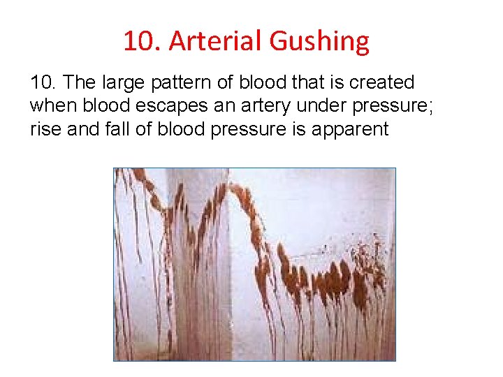 10. Arterial Gushing 10. The large pattern of blood that is created when blood