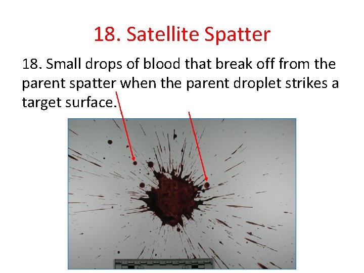18. Satellite Spatter 18. Small drops of blood that break off from the parent
