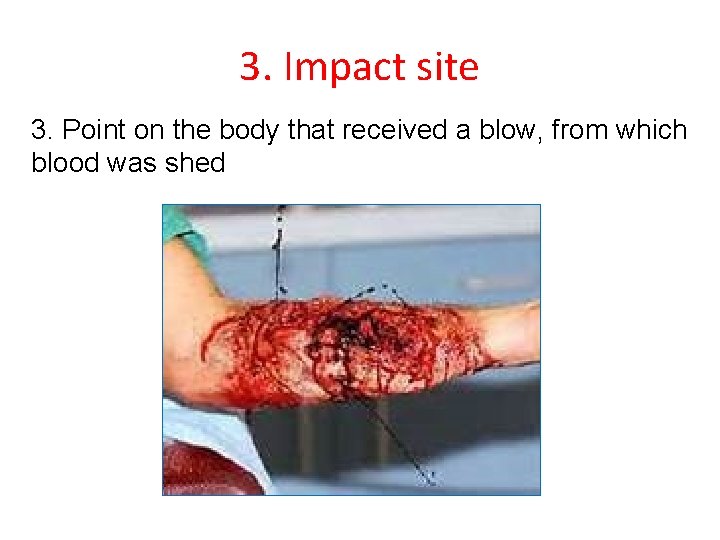 3. Impact site 3. Point on the body that received a blow, from which