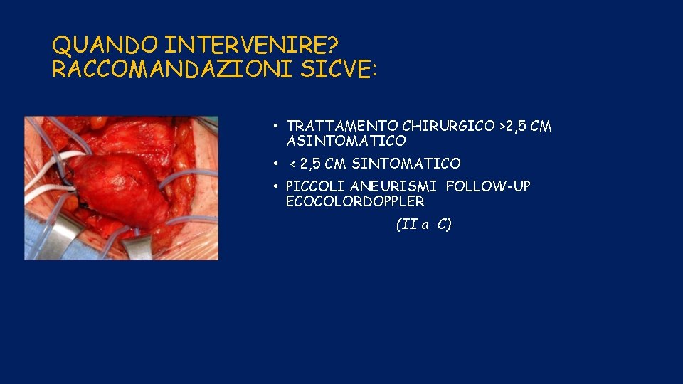 QUANDO INTERVENIRE? RACCOMANDAZIONI SICVE: • TRATTAMENTO CHIRURGICO >2, 5 CM ASINTOMATICO • < 2,